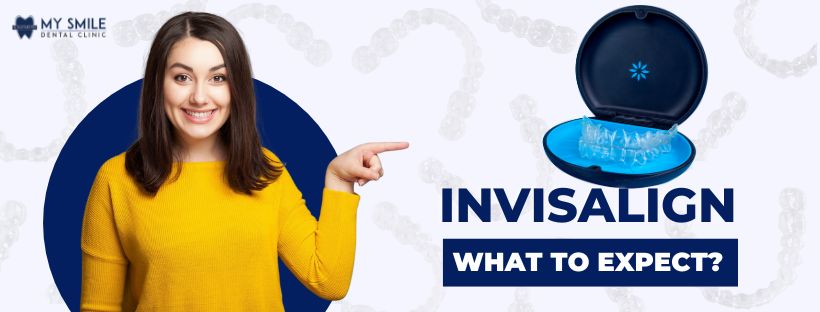 Invisalign - What to expect?