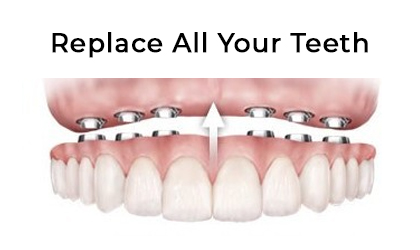 replace all teeth