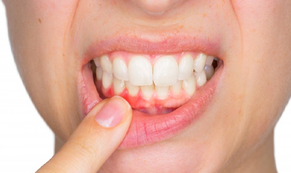 gum treatment in andheri west